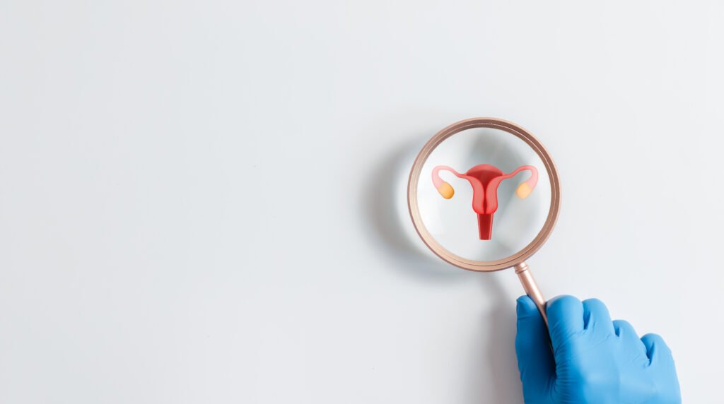 PCOS Care By Dr. Nehi Parikh